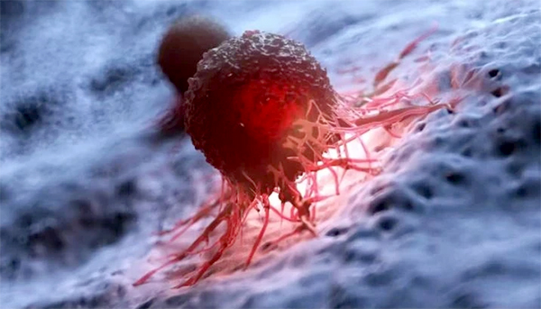 Phát hiện cơ chế hệ miễn dịch có thể nhận biết và tiêu diệt tế bào ung thư